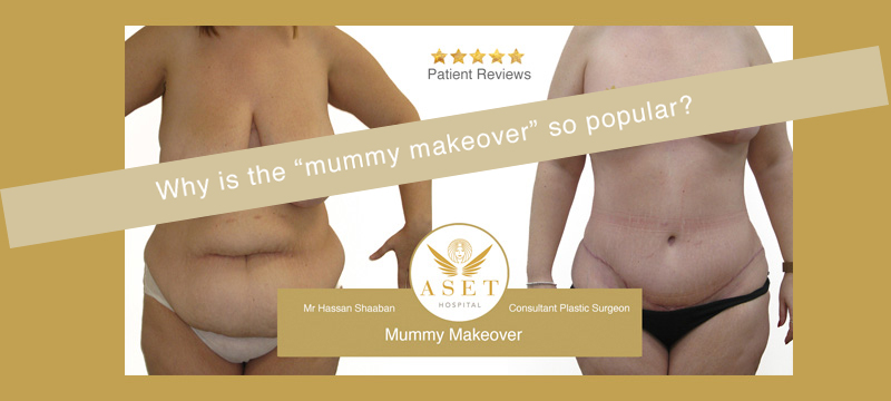 mummy makeover before and after photograph